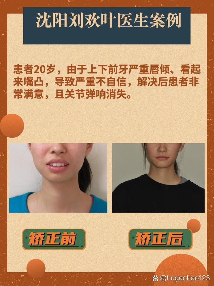 沈阳牙齿矫正去哪好-图2