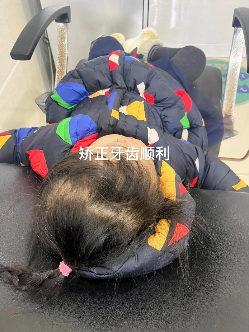 沈阳牙齿矫正去哪好-图3