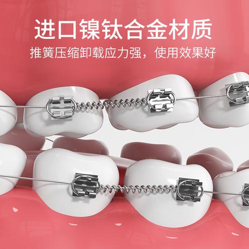 为什么矫正牙齿要戴小弹簧？它到底有什么作用？-图1