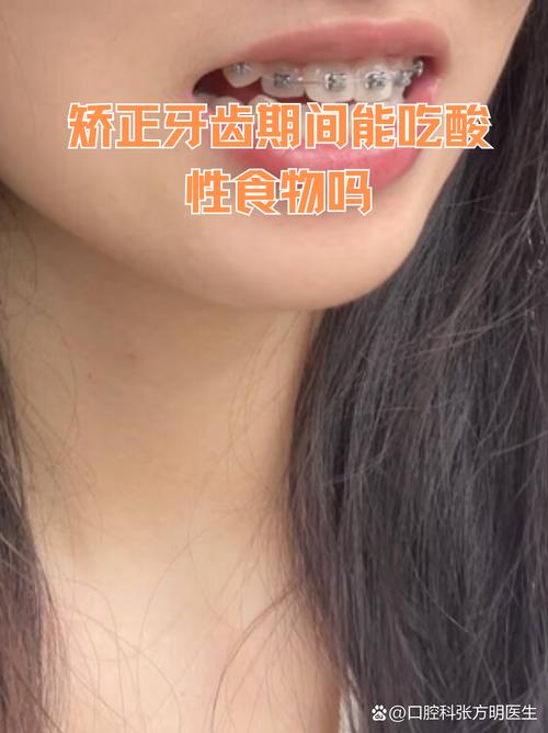 矫正牙齿期间，到底能不能正常吃东西？-图1