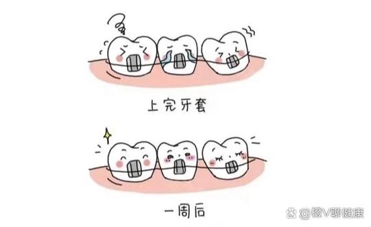 牙齿矫正酸疼怎么办-图3