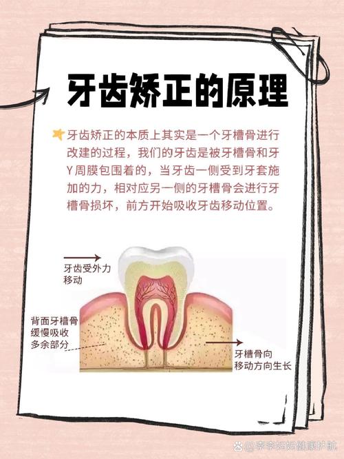 矫正牙齿会掉牙早吗？-图2