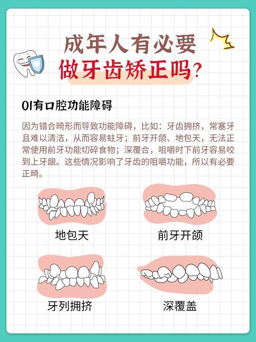 多少岁矫正牙齿合适-图2