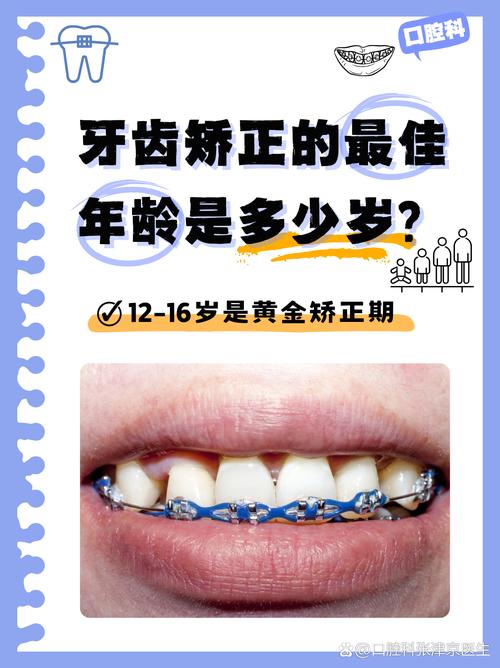 多少岁矫正牙齿合适-图3