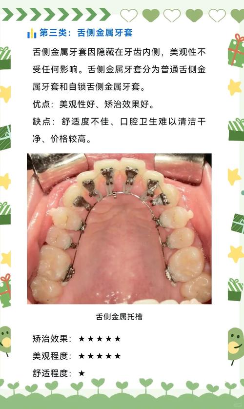 为什么矫正牙齿会酸-图3