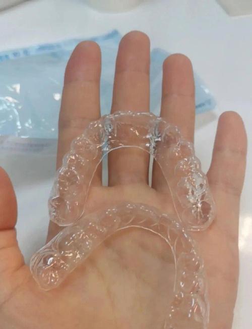 矫正完牙齿戴保持器-图3