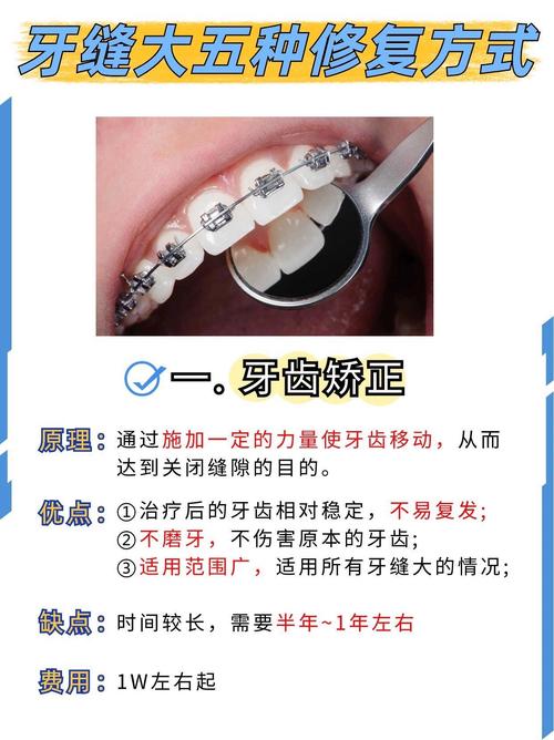 牙齿牙缝大能矫正吗-图1