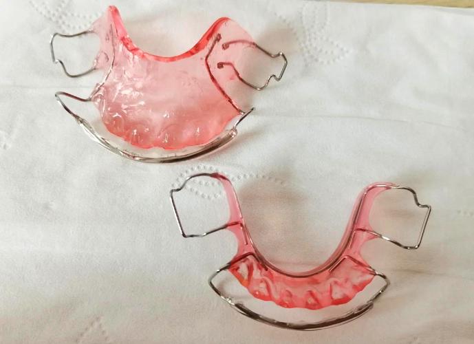 矫正牙齿后，保持器到底要戴多久？-图2