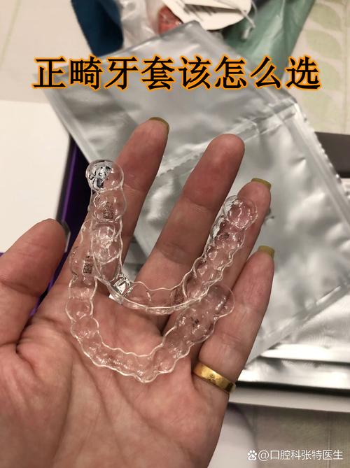 牙齿矫正戴牙套好吗？效果与利弊如何权衡？-图2