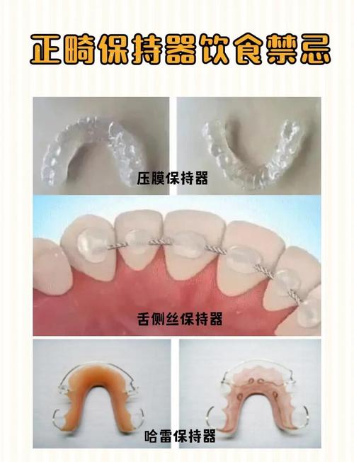 矫正牙齿后为何必须戴保持器？不戴会反弹吗？-图1