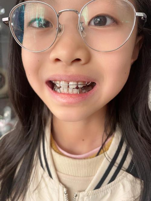 上海松江区矫正牙齿，哪家医院靠谱？效果如何？价格多少？-图1