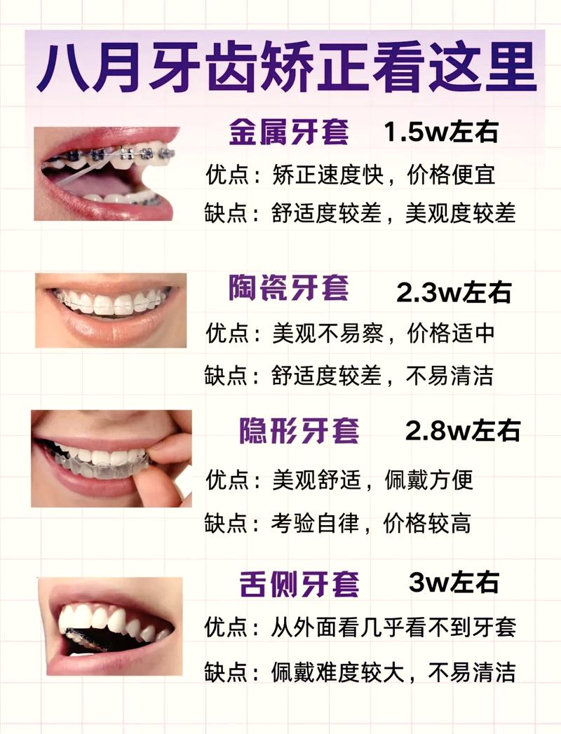 活动牙齿矫正器价格一般是多少？不同品牌差价大吗？-图1