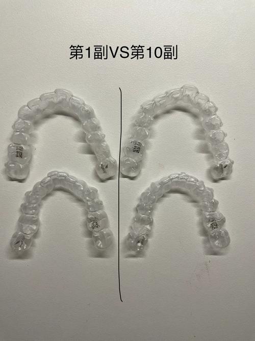 矫正牙齿选隐形牙套，效果和舒适度究竟如何？-图2
