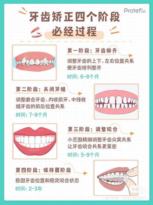 留学生怎么矫正牙齿-图1