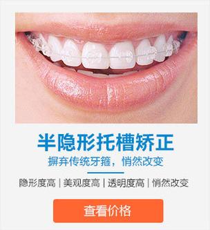 半隐形牙套矫正效果如何？适合哪些人？优缺点有哪些？-图1