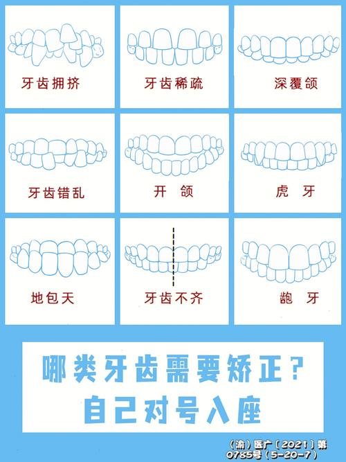 冰晶矫正牙齿大概需要多少费用呀?-图3 冰晶矫正牙齿大概需要多少费用呀?-图3