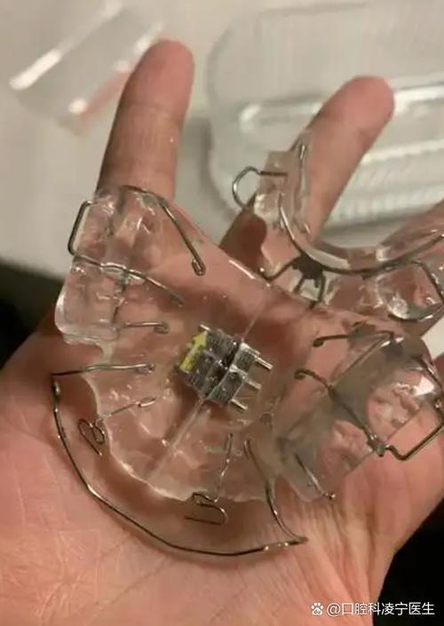 牙齿矫正器戴上牙疼-图2