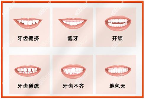南宁牙齿矫正贵吗？费用大概多少？-图3