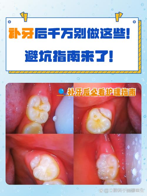 补牙后能矫正牙齿吗-图1