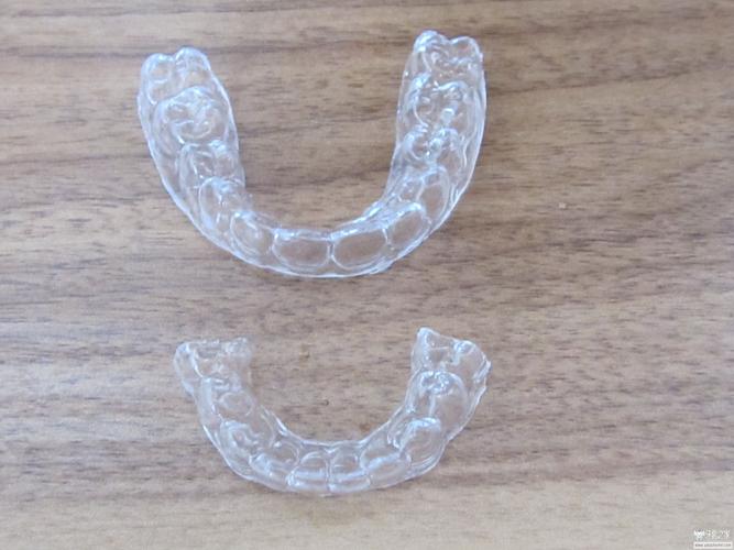 牙齿矫正完后保持器-图3