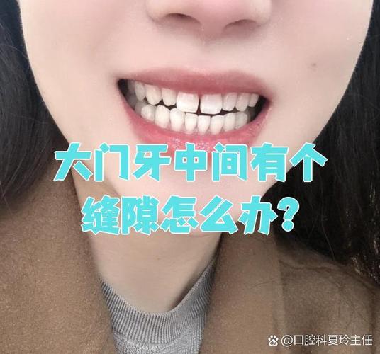 矫正完牙齿门牙为何还有缝隙？-图1