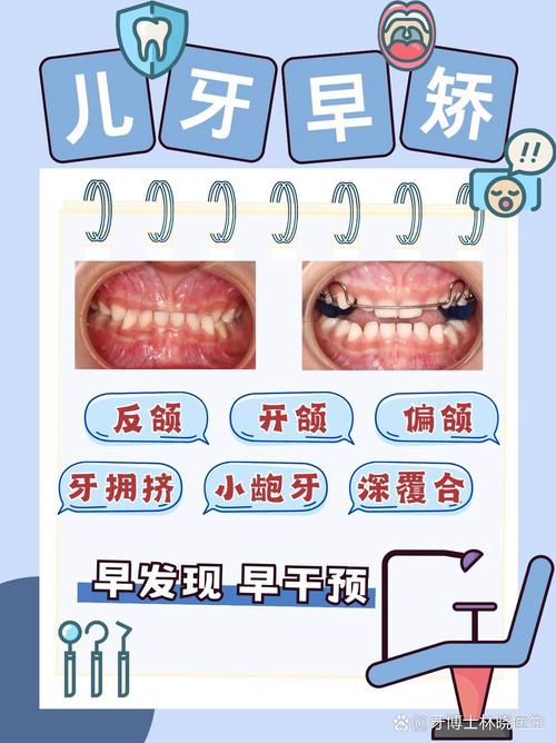 儿童牙齿矫正真的会痛吗？-图3