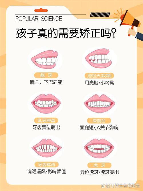 小孩矫正牙齿的危害-图2