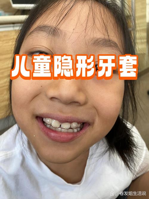 青少年隐形牙齿矫正-图1