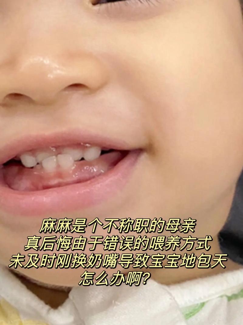 喂奶能帮助矫正牙齿吗？-图3