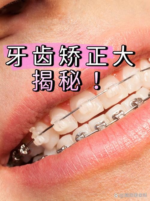 台州矫正牙齿哪里好-图1