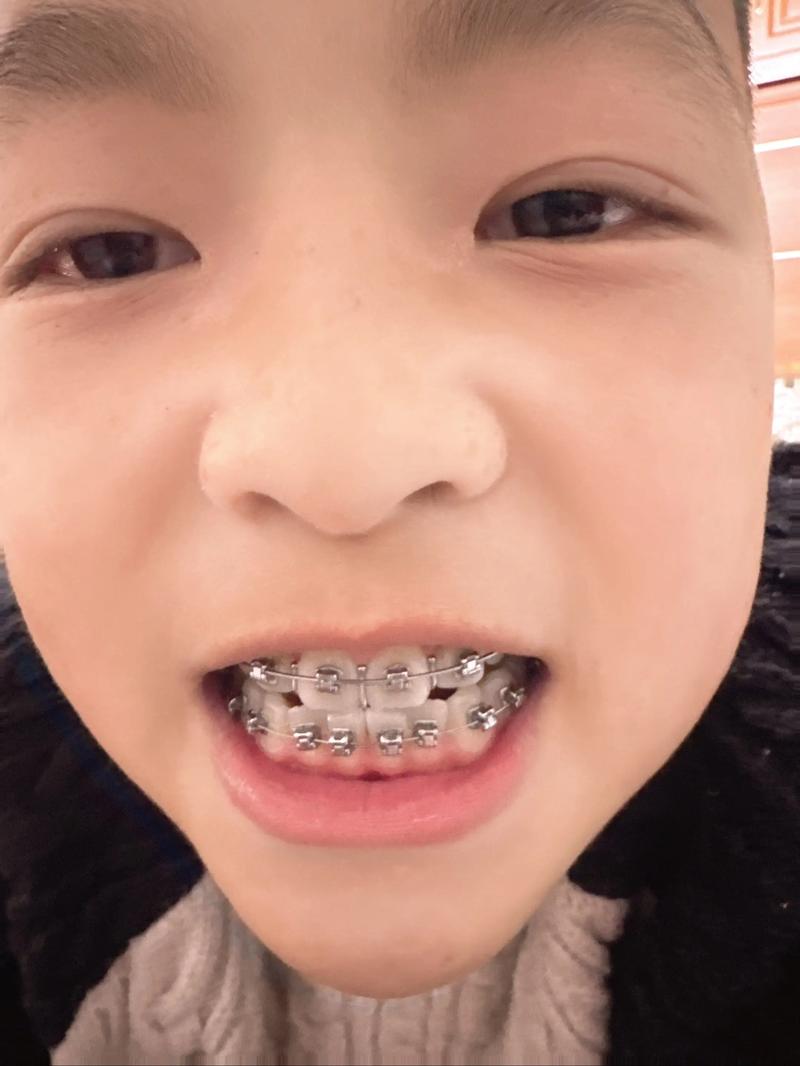 泉州整牙齿矫正去哪里好？靠谱医院医生如何挑选？-图1