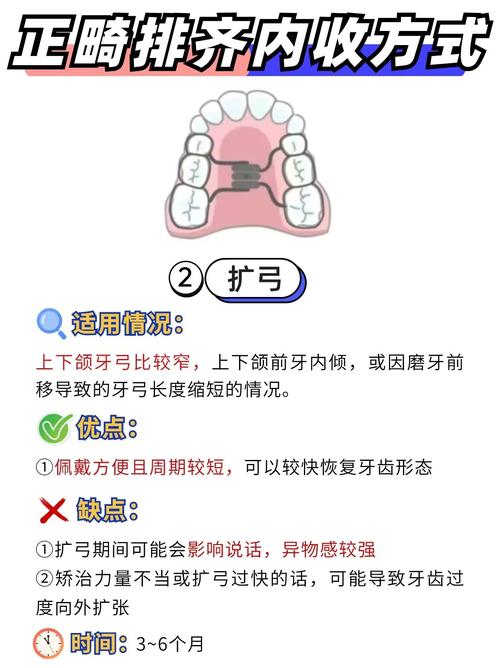 牙齿矫正怎么收牙缝？有哪些实用方法？-图2