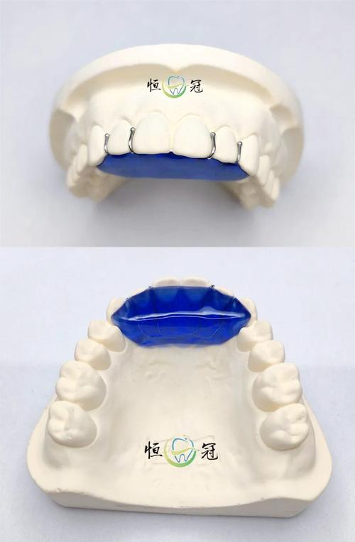 平阳牙齿矫正哪里好？求靠谱机构推荐-图2