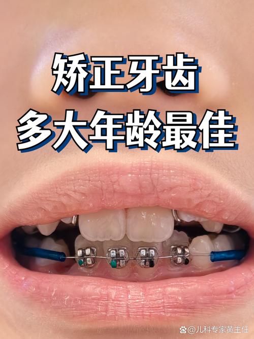 廊坊矫正牙齿去哪里好？靠谱机构和医生怎么选？-图2