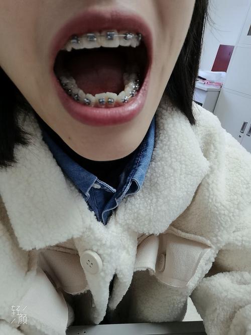 贵阳哪里做牙齿矫正靠谱？医院资质、医生技术和价格怎么选？-图2