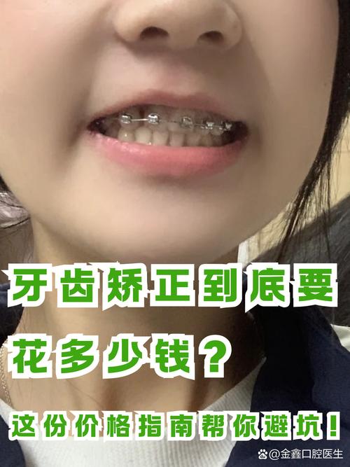 南通矫正牙齿便宜点，怎么找性价比高的方案？-图1