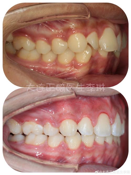 大连哪里矫正牙齿好-图2