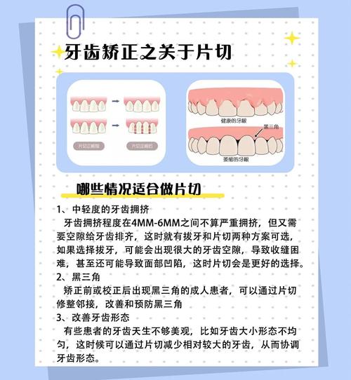 牙齿可以矫正牙缝吗-图2 牙齿可以矫正牙缝吗-图2