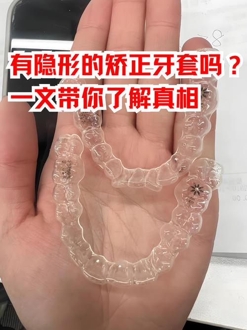 矫正牙齿选隐形的好吗？-图3