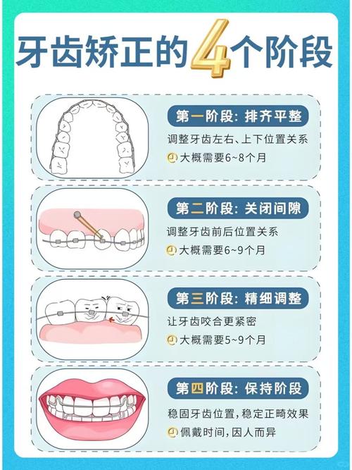矫正牙齿的全部过程-图2