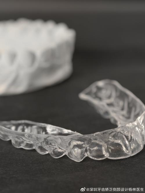隐形矫正牙齿哪个好-图2