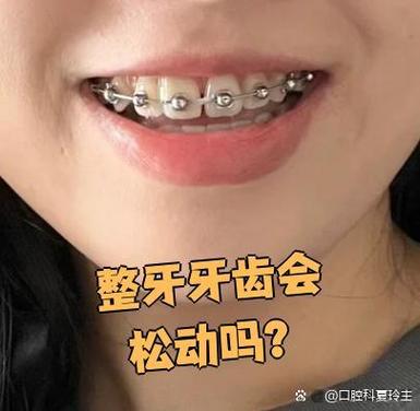 牙齿矫正会导致牙齿松动吗？-图2