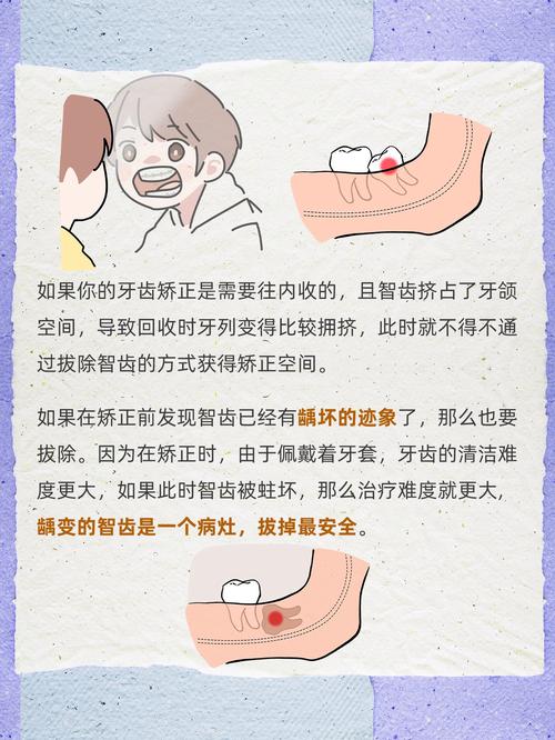 矫正牙齿拔牙是必须的吗？原因究竟是什么？-图2