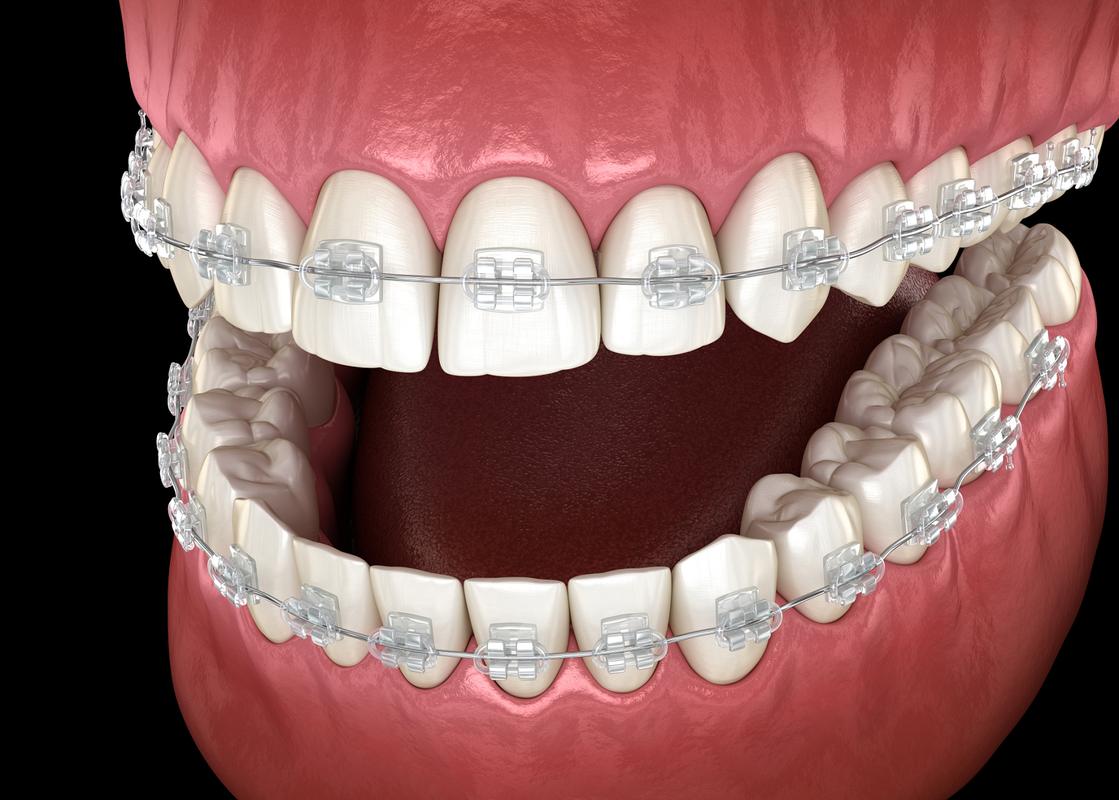 台州牙齿矫正哪家医院好？-图1