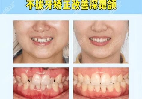 北京牙齿矫正哪家好？求推荐靠谱机构，想看真实案例反馈！-图1