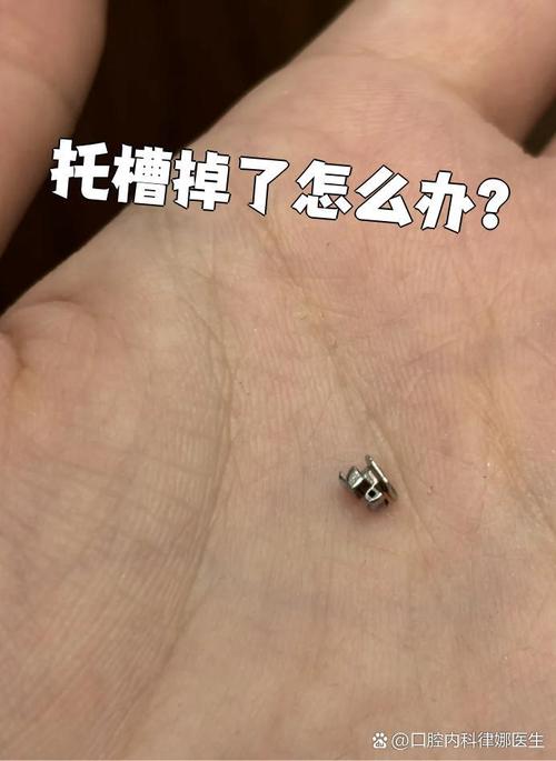 矫正牙齿托槽松了该如何处理？-图2