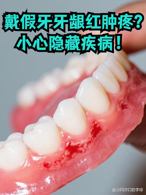 矫正牙齿期间牙龈发炎，是什么原因导致的？该如何正确护理和处理？-图1