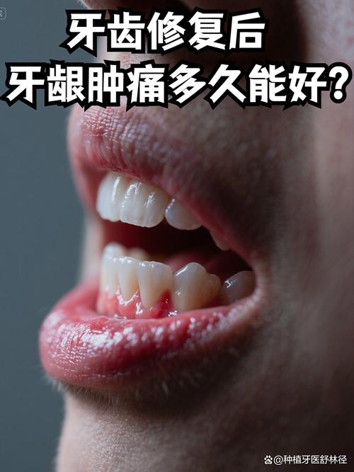 矫正牙齿期间牙龈发炎，是什么原因导致的？该如何正确护理和处理？-图2