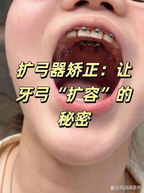 带牙齿矫正器有用吗-图3 带牙齿矫正器有用吗-图3