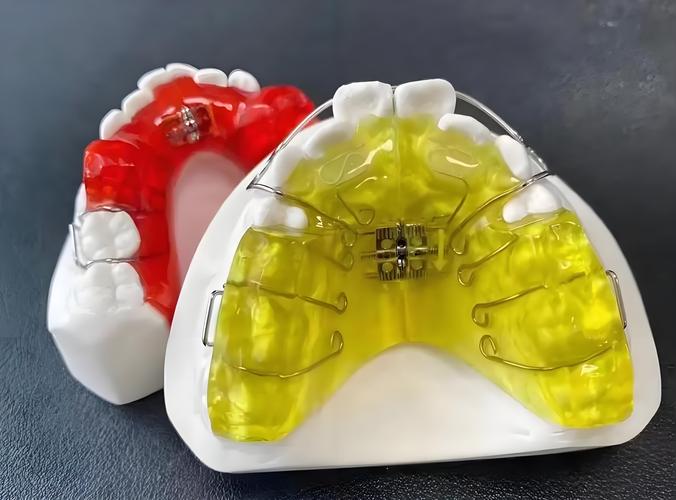 牙齿矫正器的作用具体有哪些？能解决什么牙齿问题？-图3